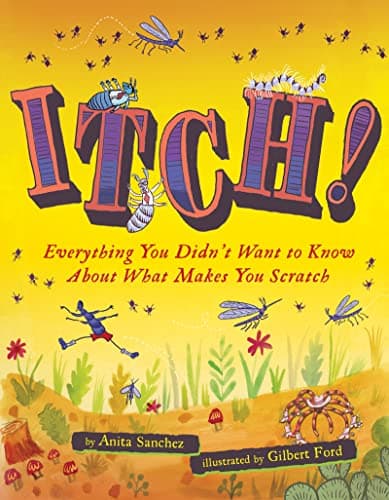 Cover of Itch! Everything You Didn't Want to Know About What Makes You Scratch