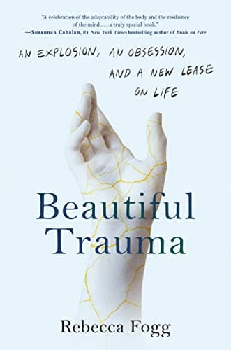 Cover of Beautiful Trauma: An Explosion, an Obsession, and a New Lease on Life